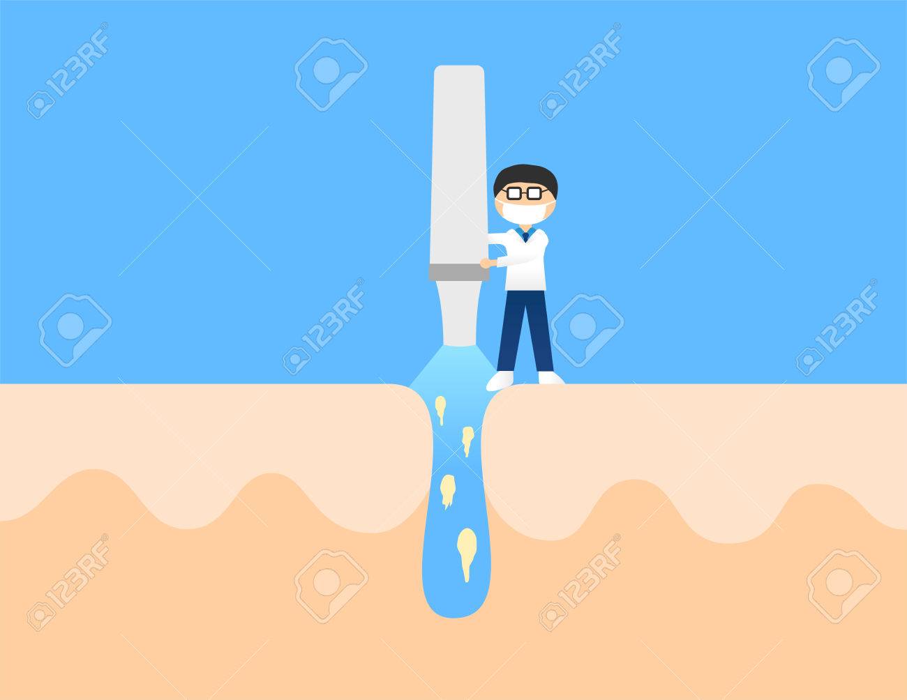 acne and pimples doctor