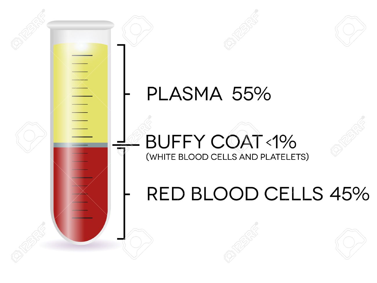 Where do elevated red blood cells come from Where do elevated red blood cells come from
