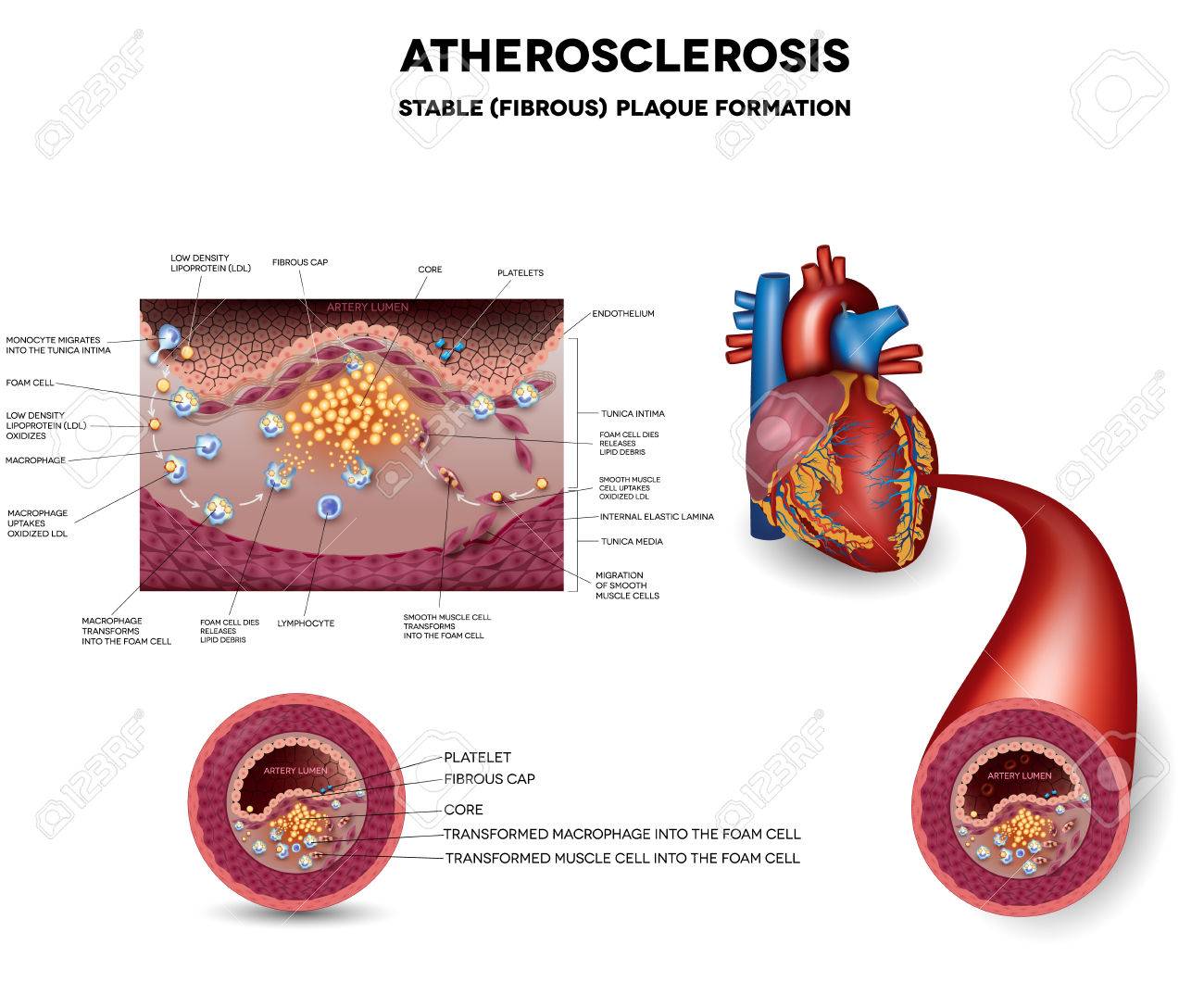 atherosclerosis docx Atherosclerosis malnutrition matrix gla protein osteocalcin surgery vitamin k docx-document (docx, 25 kb) scifeed alert for new publications never. atherosclerosis docx Atherosclerosis malnutrition matrix gla protein osteocalcin surgery vitamin k docx-document (docx, 25 kb) scifeed alert for new publications never.