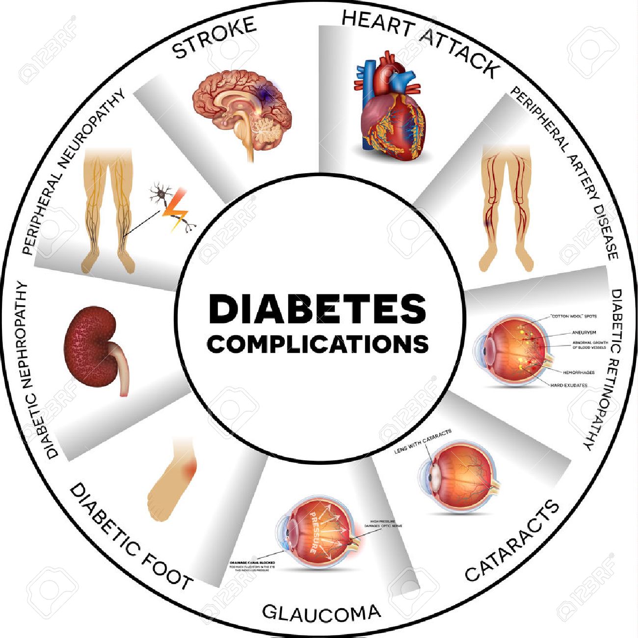 diabetes ojo daño renal