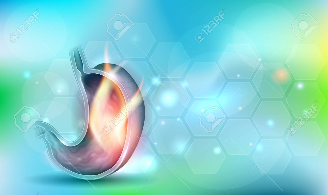 Stomach disorder abstract design on a beautiful light blue background, fire inside of the stomach - 121825877 Stomach disorder abstract design on a beautiful light blue background, fire inside of the stomach - 121825877