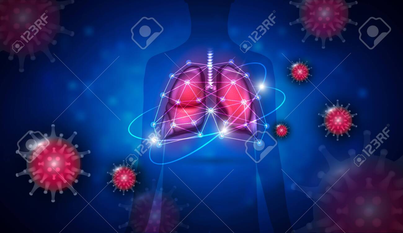 Pneumonia caused by Coronavirus respiratory tract infection complication, treatment concept - 143852663 Pneumonia caused by Coronavirus respiratory tract infection complication, treatment concept - 143852663