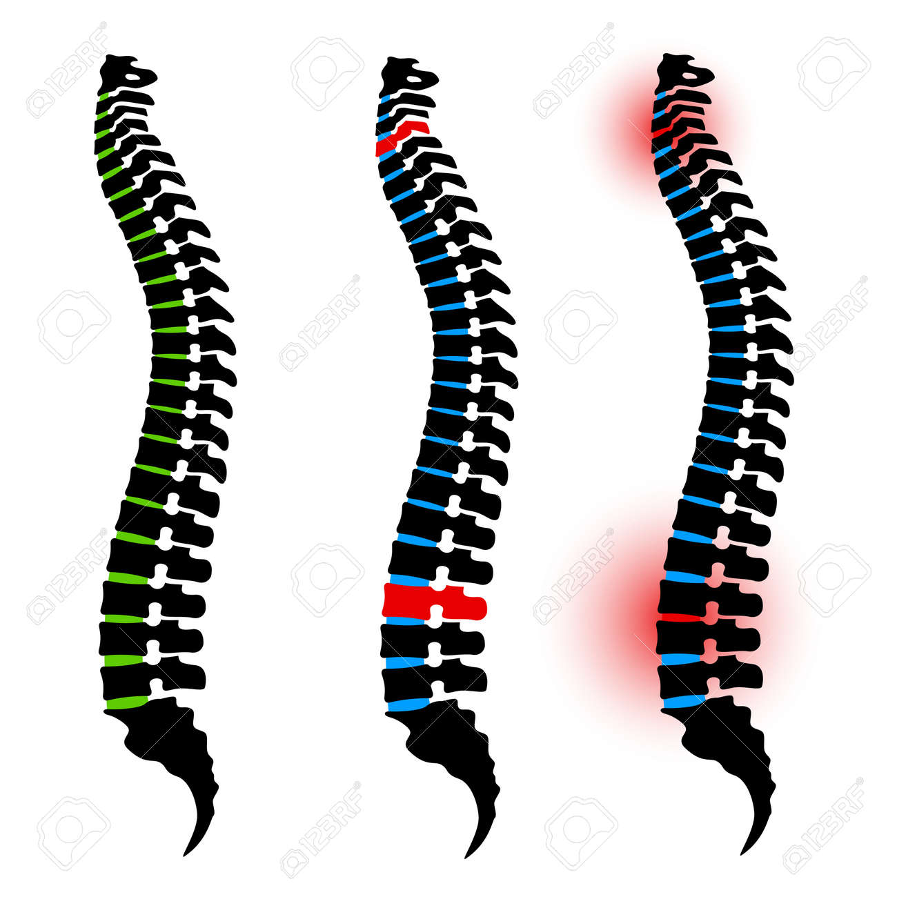人間の背骨のシルエット のイラスト素材 ベクタ Image 人間の背骨のシルエット のイラスト素材 ベクタ Image