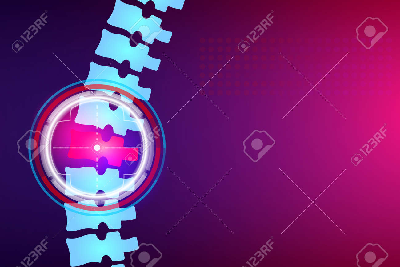 Creative illustration of spine x-ray, pain neck, disk degradation, injury treatment on background. Art design medical banner template. Abstract concept healthcare infographic graphic element. - 120958146 Creative illustration of spine x-ray, pain neck, disk degradation, injury treatment on background. Art design medical banner template. Abstract concept healthcare infographic graphic element. - 120958146