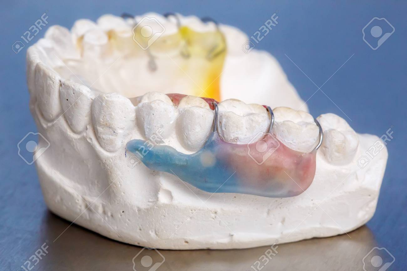 clay teeth model