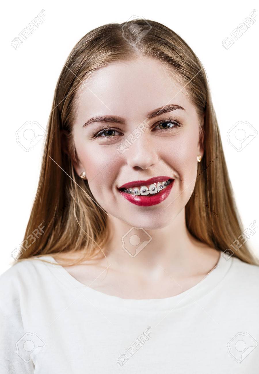 Teen Girls With Braces