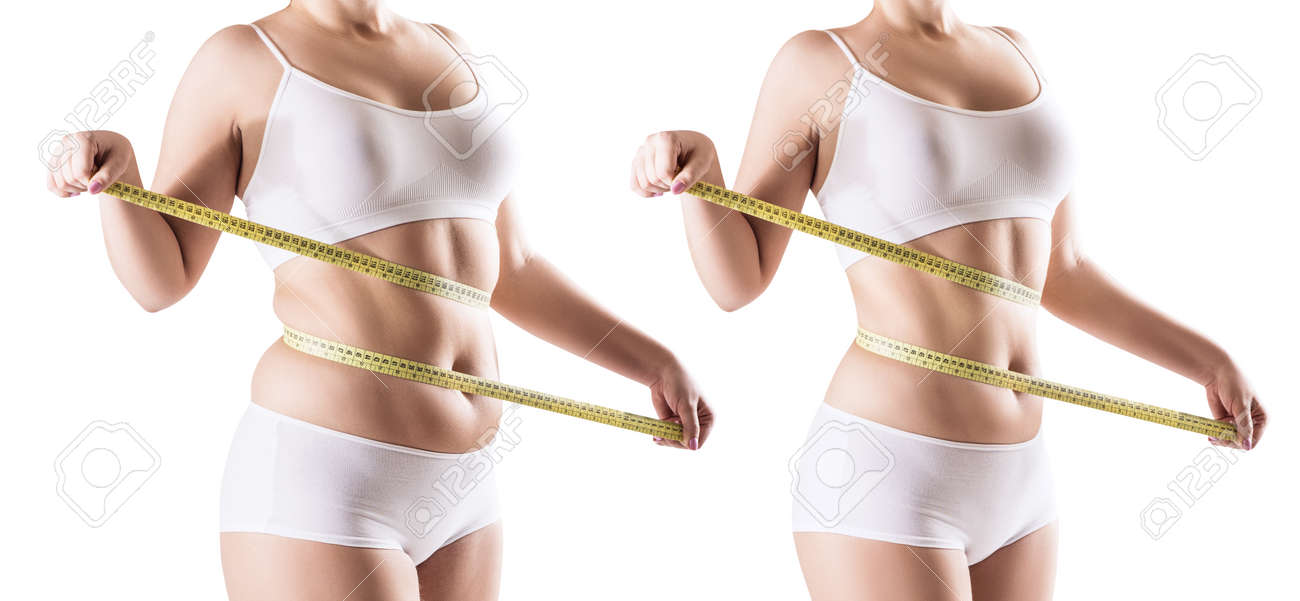 Womans body before and after weight loss. - 90574753 Womans body before and after weight loss. - 90574753