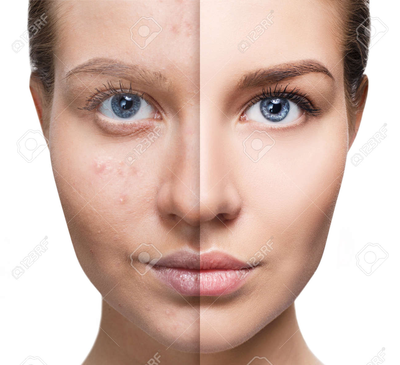 Download Problemes de peau Free