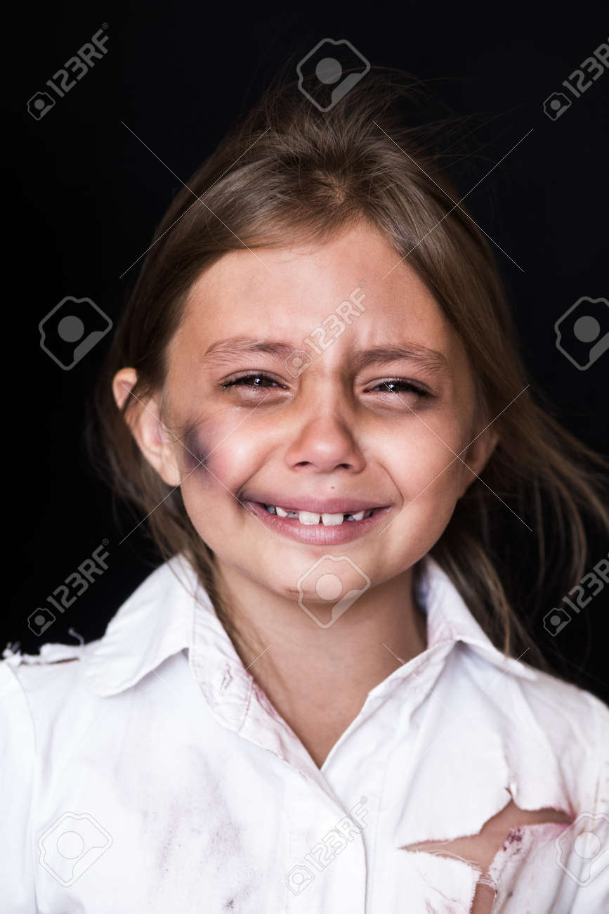 児童虐待 悲しく 孤独な女の子は泣いています けがをした子供の家庭内暴力の被害者を装った の写真素材 画像素材 Image