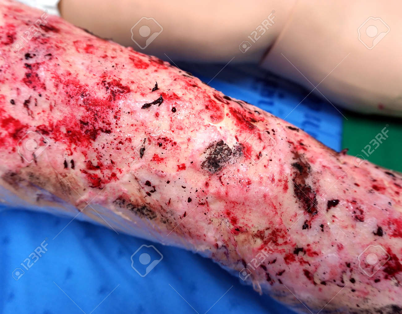 abrasion wound on leg for learning in laboratory simulation stock
