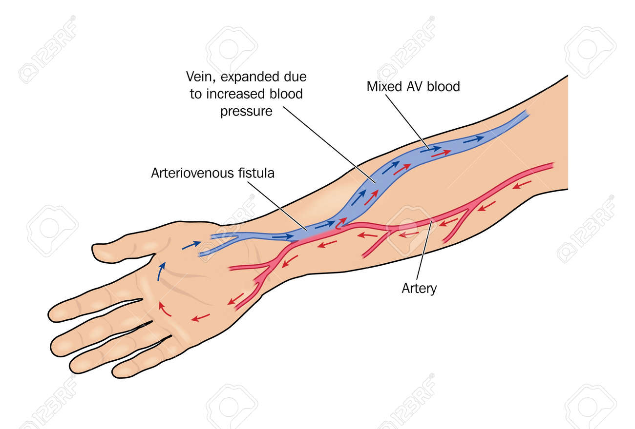 venas y arterias de brazo venas y arterias de brazo