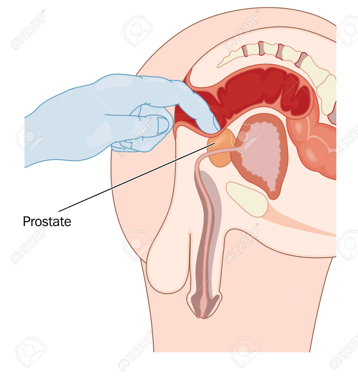 prostata francais