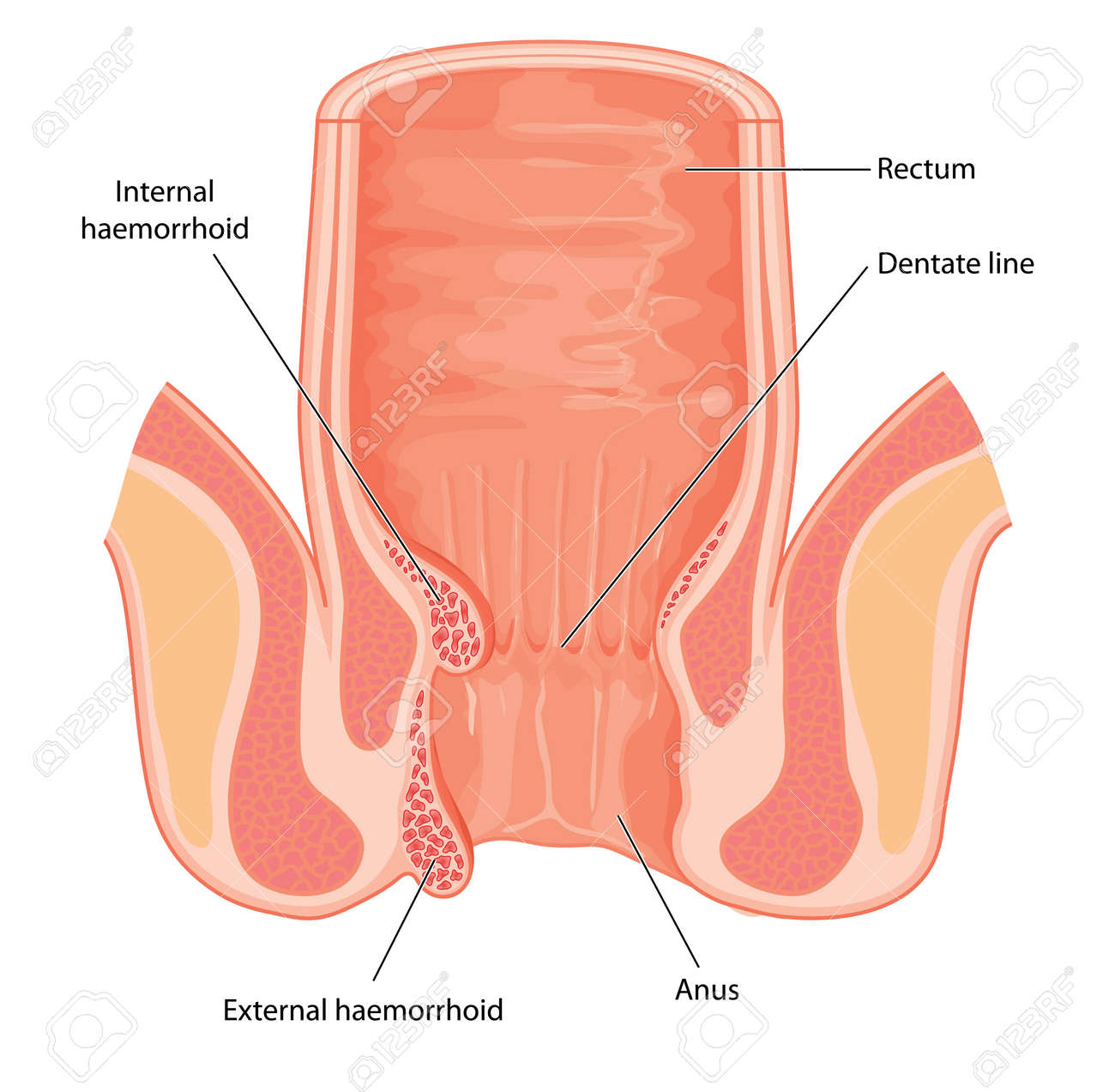 Diagram of the rectum