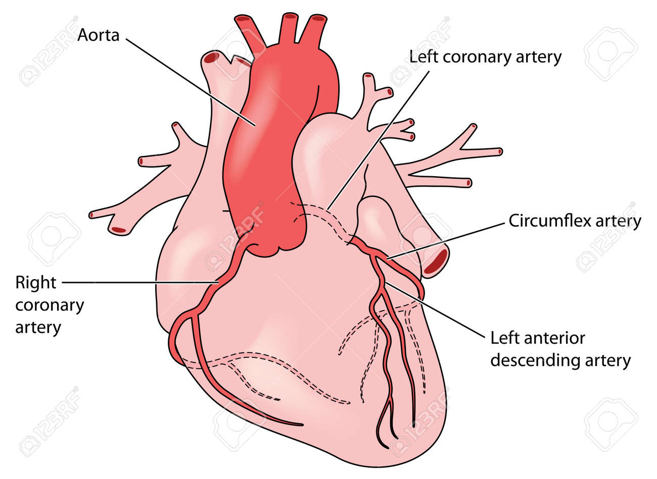 The Coronary Arteries Of The Heart Anterior View Including The Left Anterior Descending Artery Created In Adobe Illustrator Eps 10 Royalty Free Cliparts Vectors And Stock Illustration Image 46942907