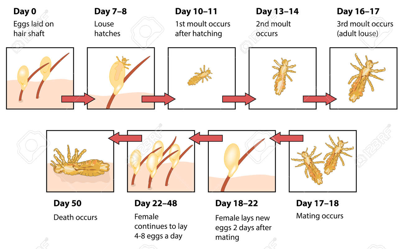 The Life Cycle Of Head Lice Showing Eggs On Hair Shaft, Hatching, Moulting, Mating And Death Of Lice In Human Hair Royalty Free SVG, Cliparts, Vectors, And Stock Illustration. Image 78165824. The Life Cycle Of Head Lice Showing Eggs On Hair Shaft, Hatching, Moulting, Mating And Death Of Lice In Human Hair Royalty Free SVG, Cliparts, Vectors, And Stock Illustration. Image 78165824.