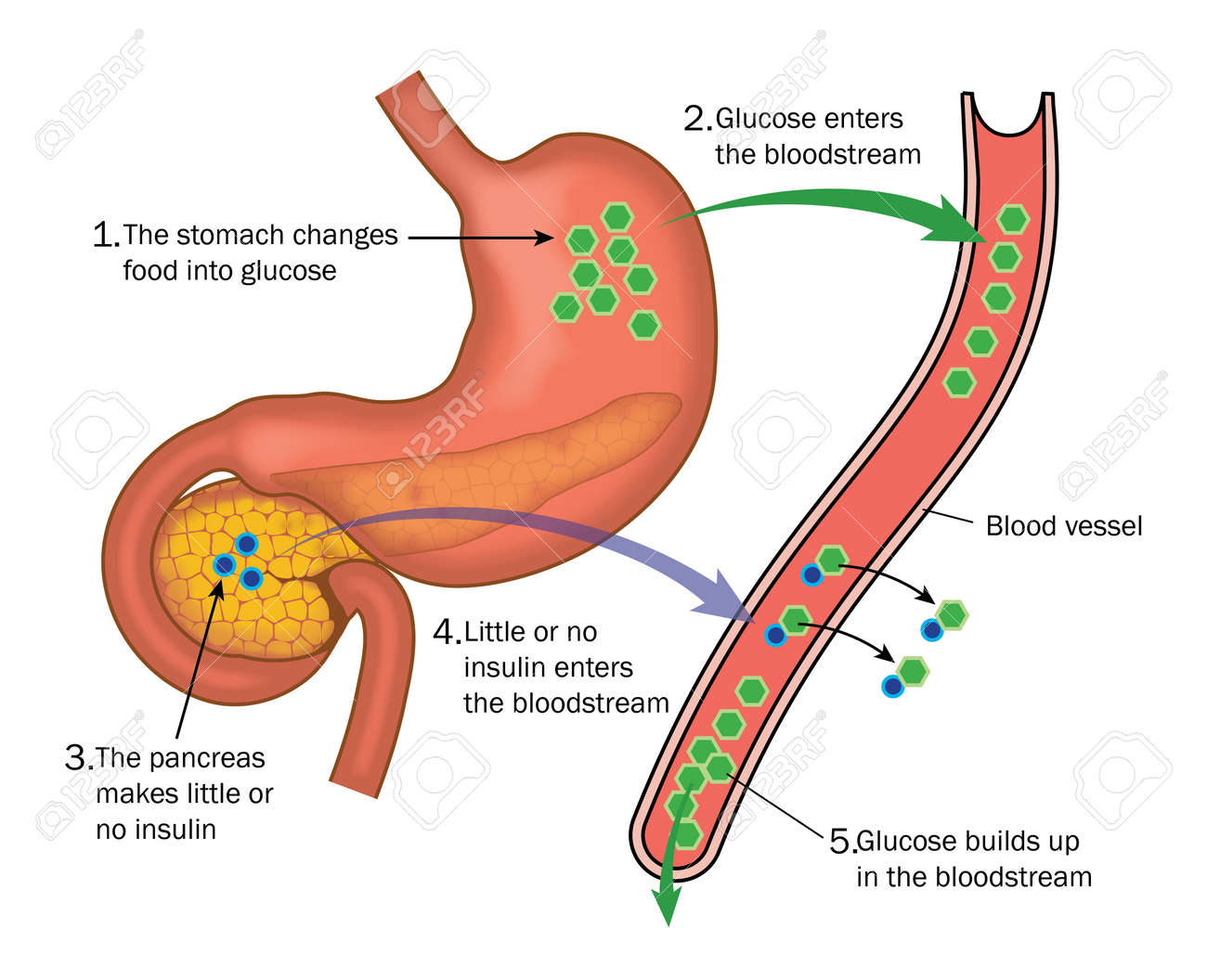 Metabolismo de la glucosa
