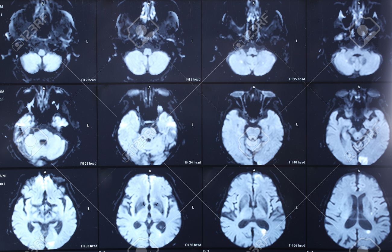 Ct Scan X Rays Ct Scan Machine Ct Scan X Rays Ct Scan Machine