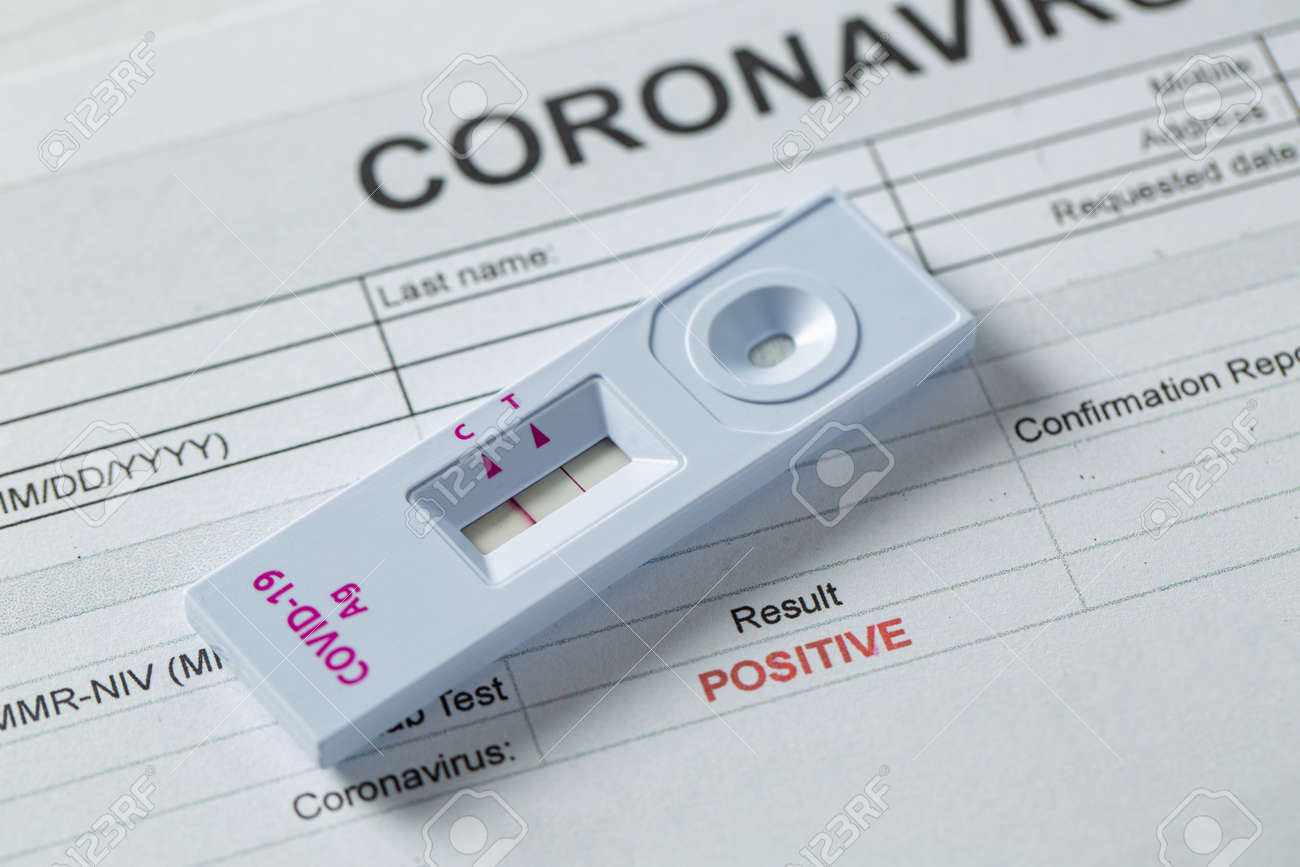 O kit de teste rápido de antígeno para verificar o resultado do coronavírus é positivo com o documento do relatório.covid-19 ag com teste rápido nasal. infecção por doença do vírus de verificação rápida saudável. - 172772909 O kit de teste rápido de antígeno para verificar o resultado do coronavírus é positivo com o documento do relatório.covid-19 ag com teste rápido nasal. infecção por doença do vírus de verificação rápida saudável. - 172772909