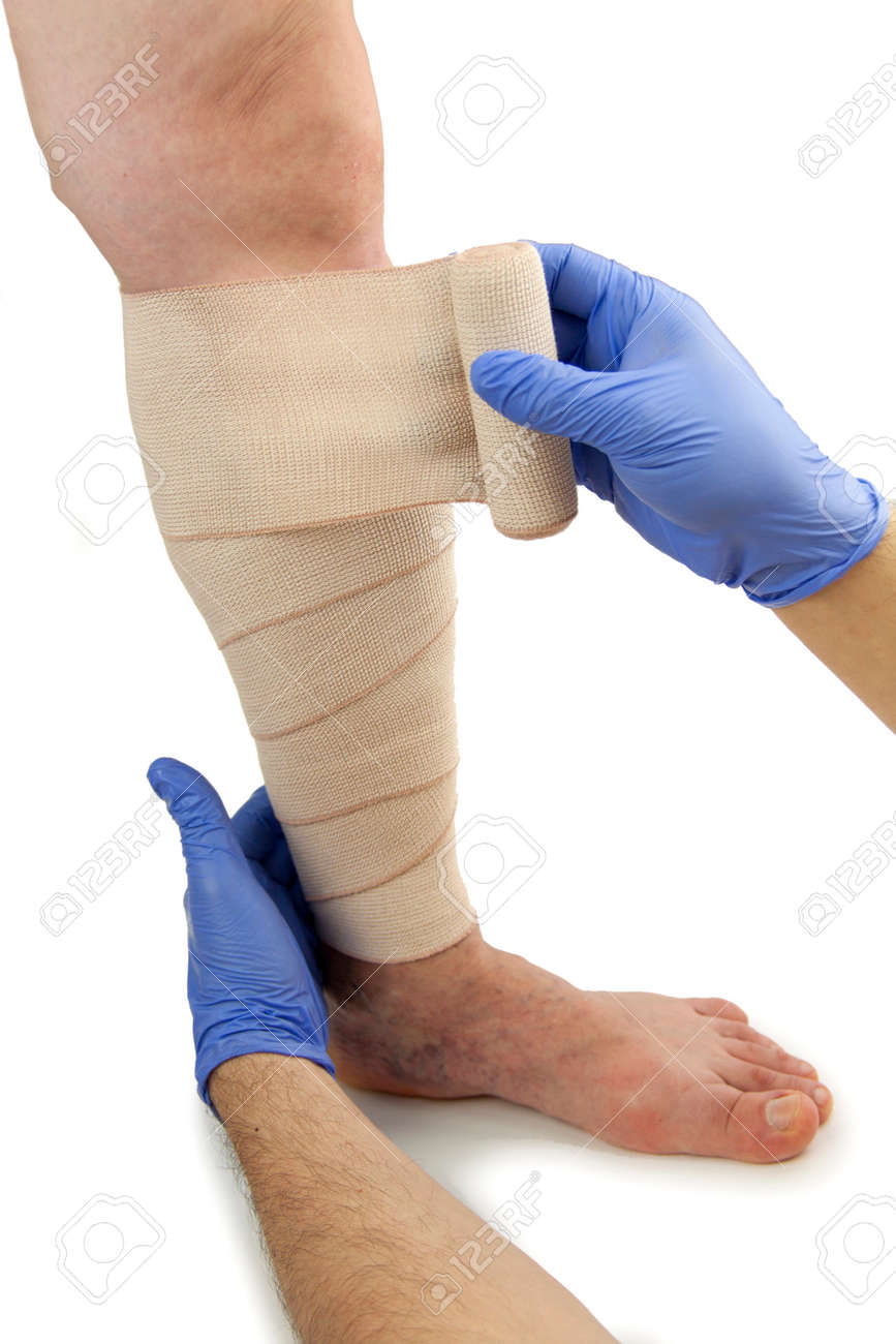 bandage în varicoza