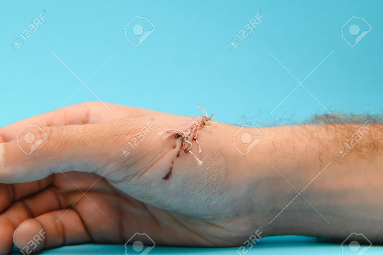 etiam-dictum-ipsum-a-felis