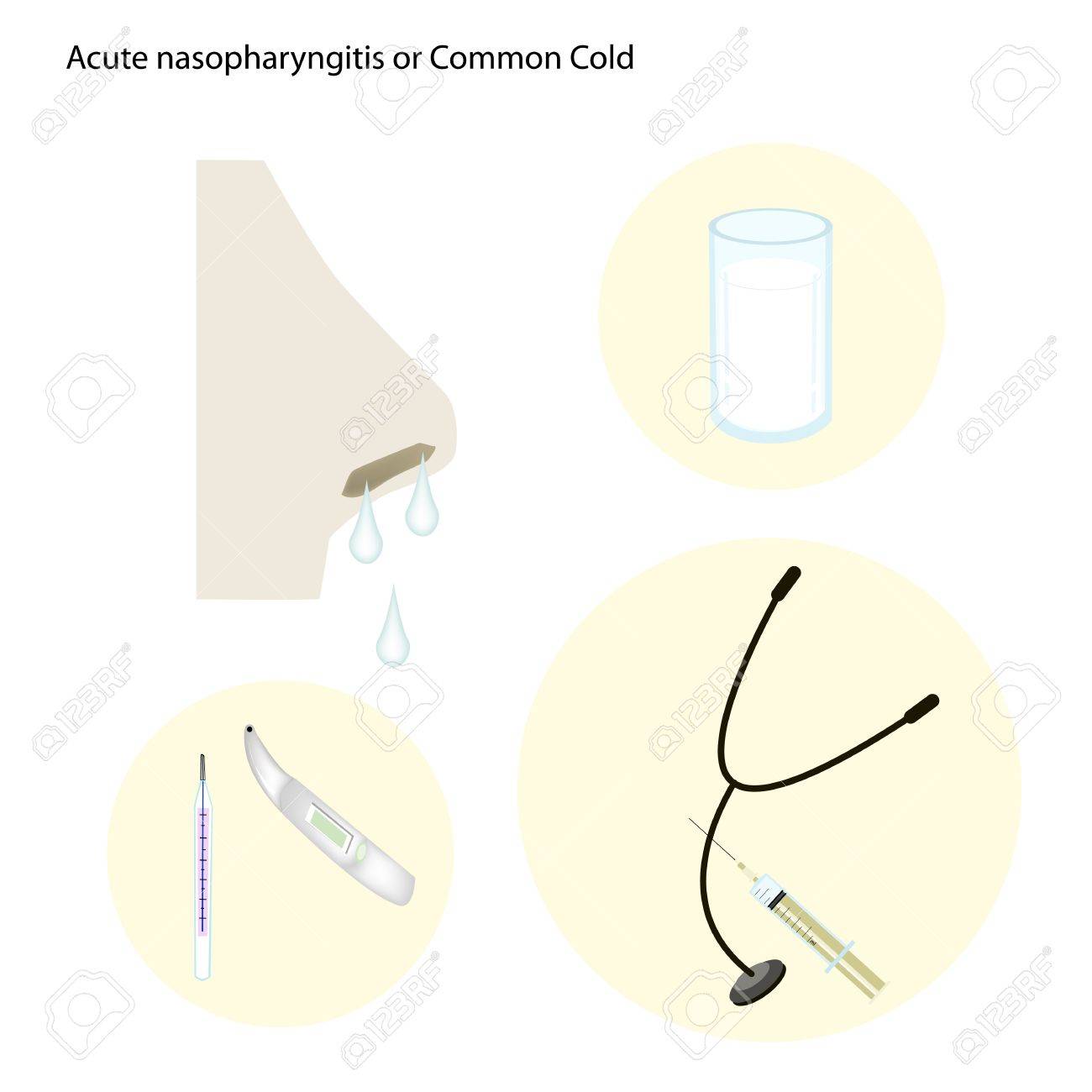 風邪鼻咽頭炎 Rhinopharyngitis または急性性鼻炎の予防と治療の医療コンセプト イラスト のイラスト素材 ベクタ Image