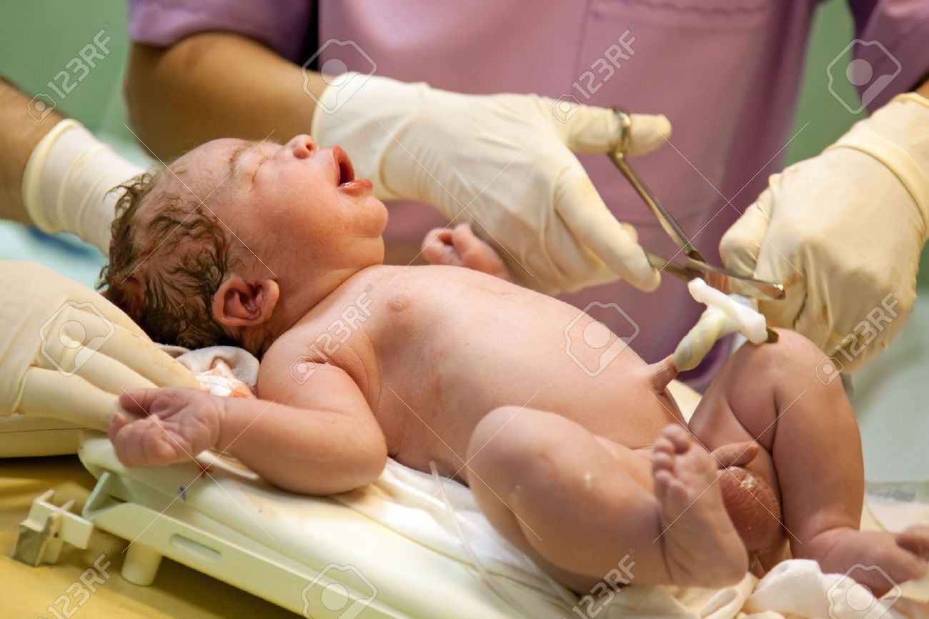 new born baby being treated just after the birth stock photo