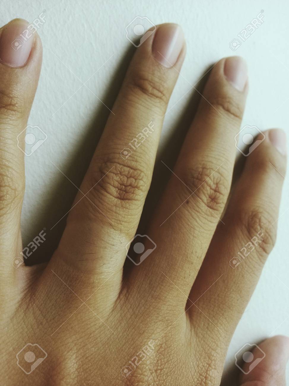 etiam-dictum-ipsum-a-felis