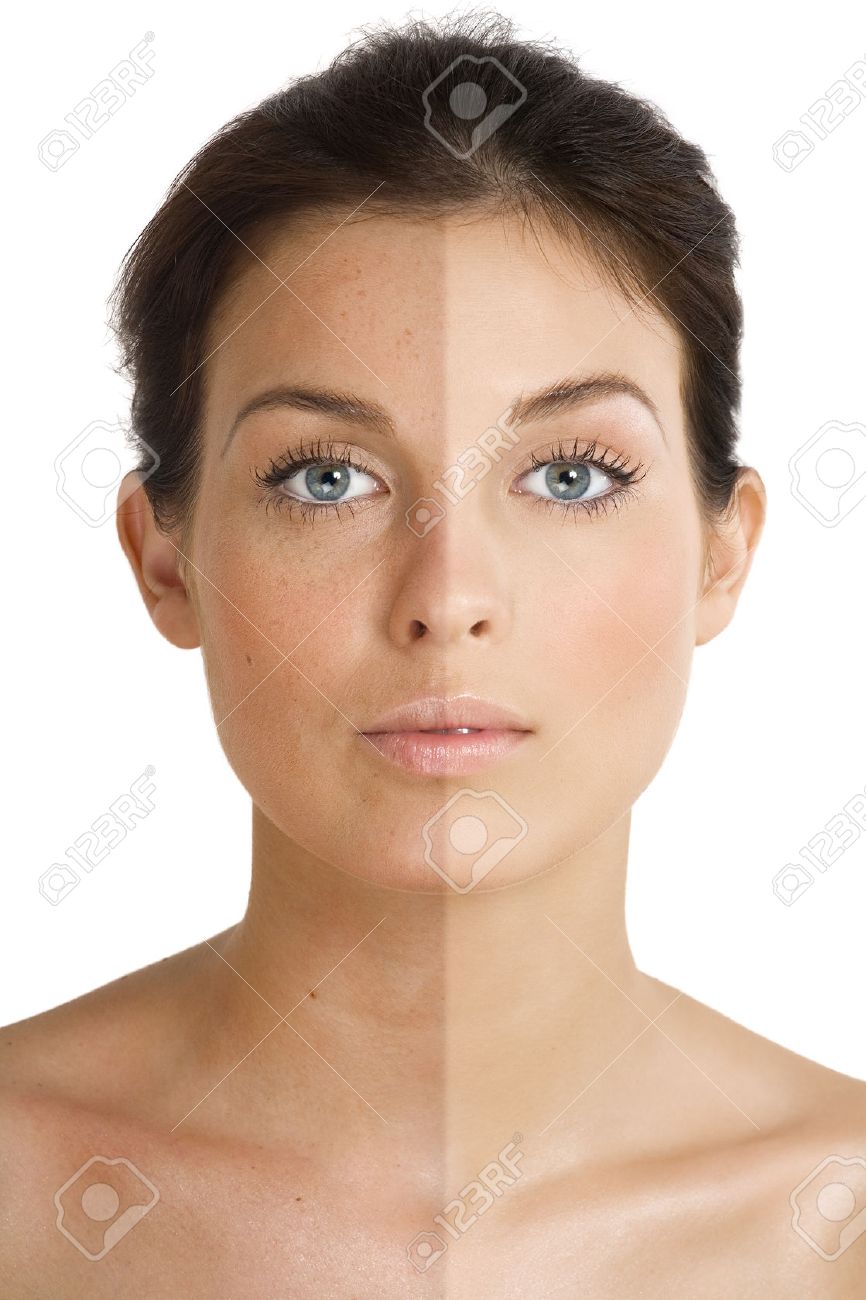 Female face divided into two parts one healthy and one UV damaged. - 38465582 Female face divided into two parts one healthy and one UV damaged. - 38465582