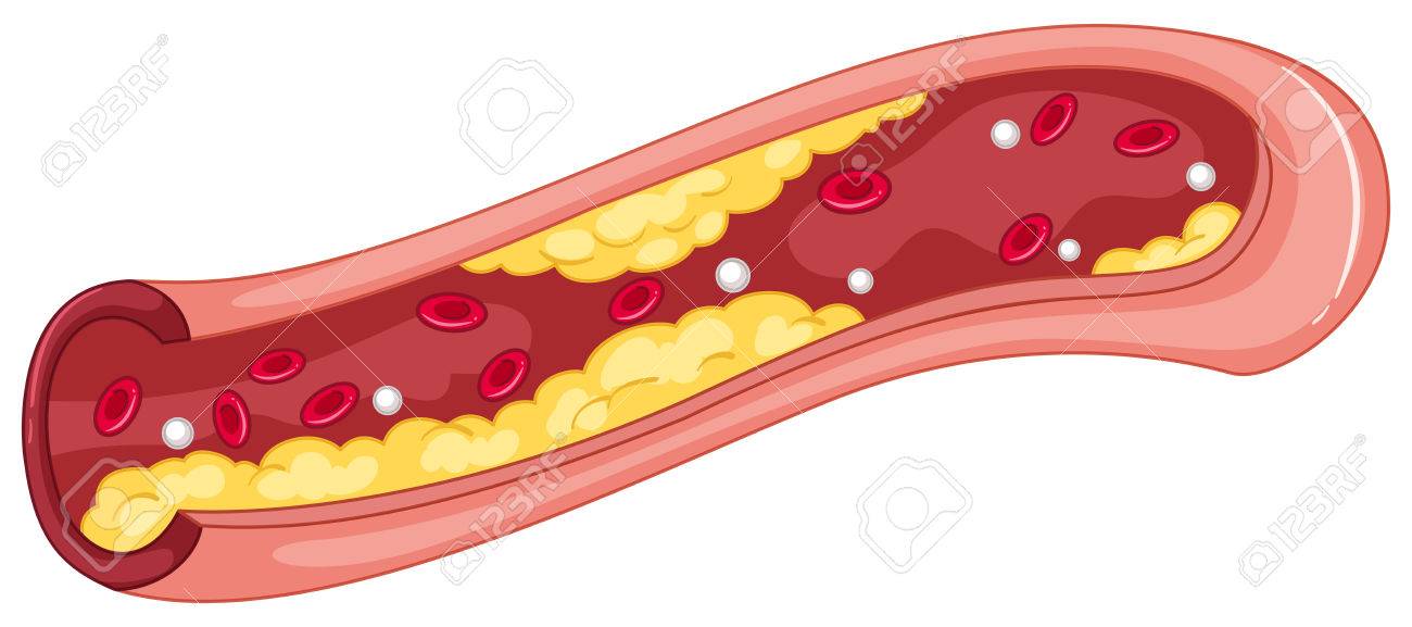 Schema De Caillot De Sang Sur Fond Blanc Illustration Clip Art Libres De Droits Vecteurs Et Illustration Image