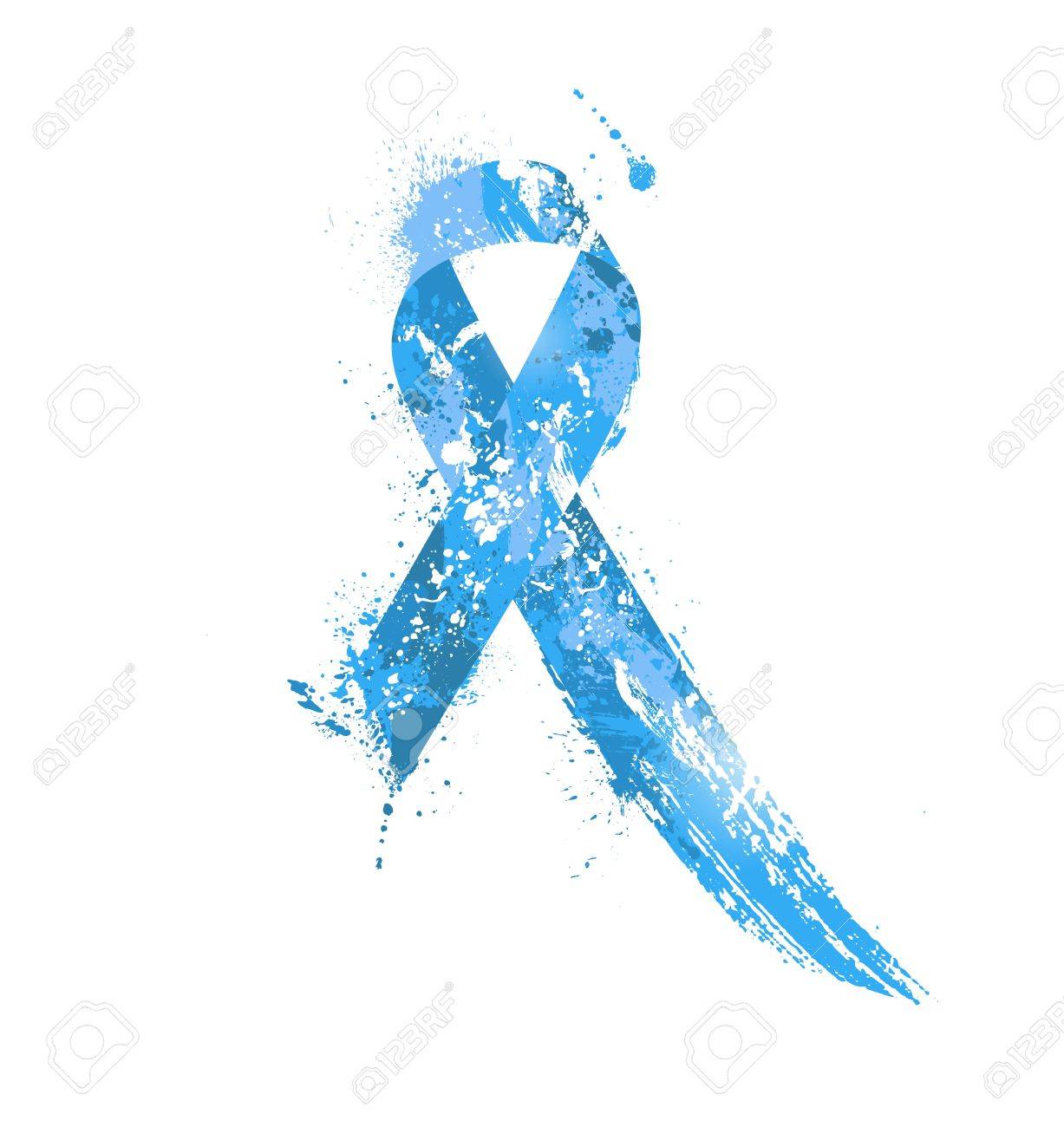 cáncer de próstata transparente cáncer de próstata transparente