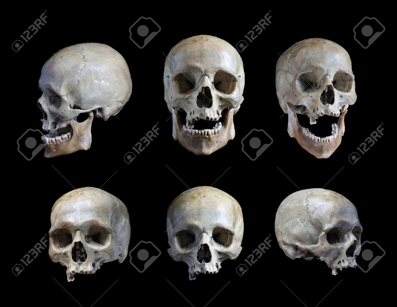 skull of the person