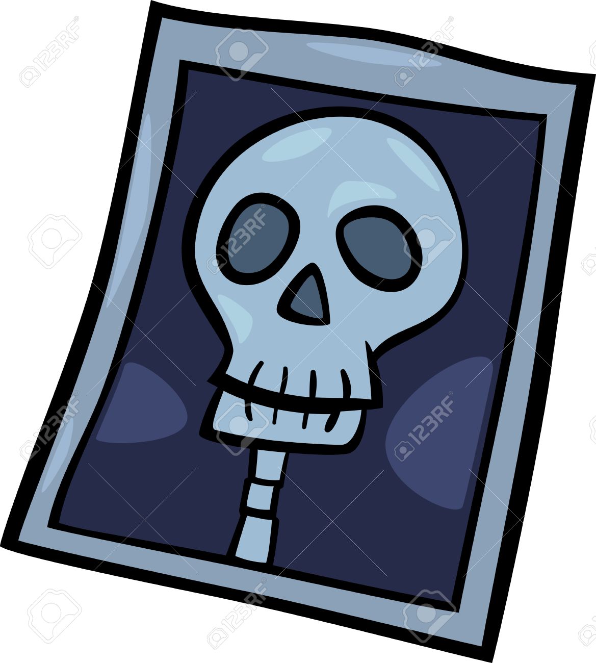 Ilustracion De Dibujos Animados De Rayos X Foto Clip Art Cabeza