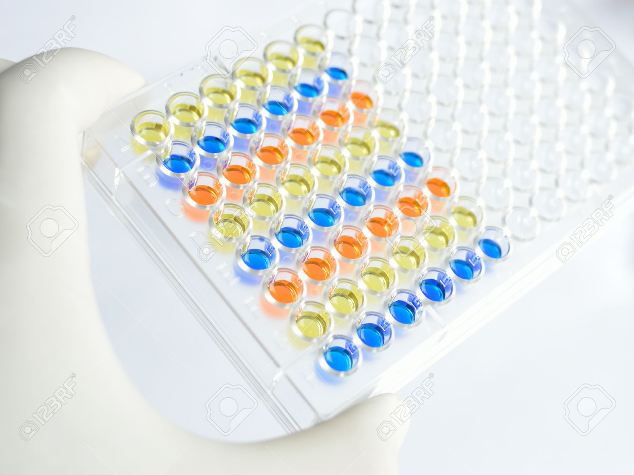 enzyme immunoassay