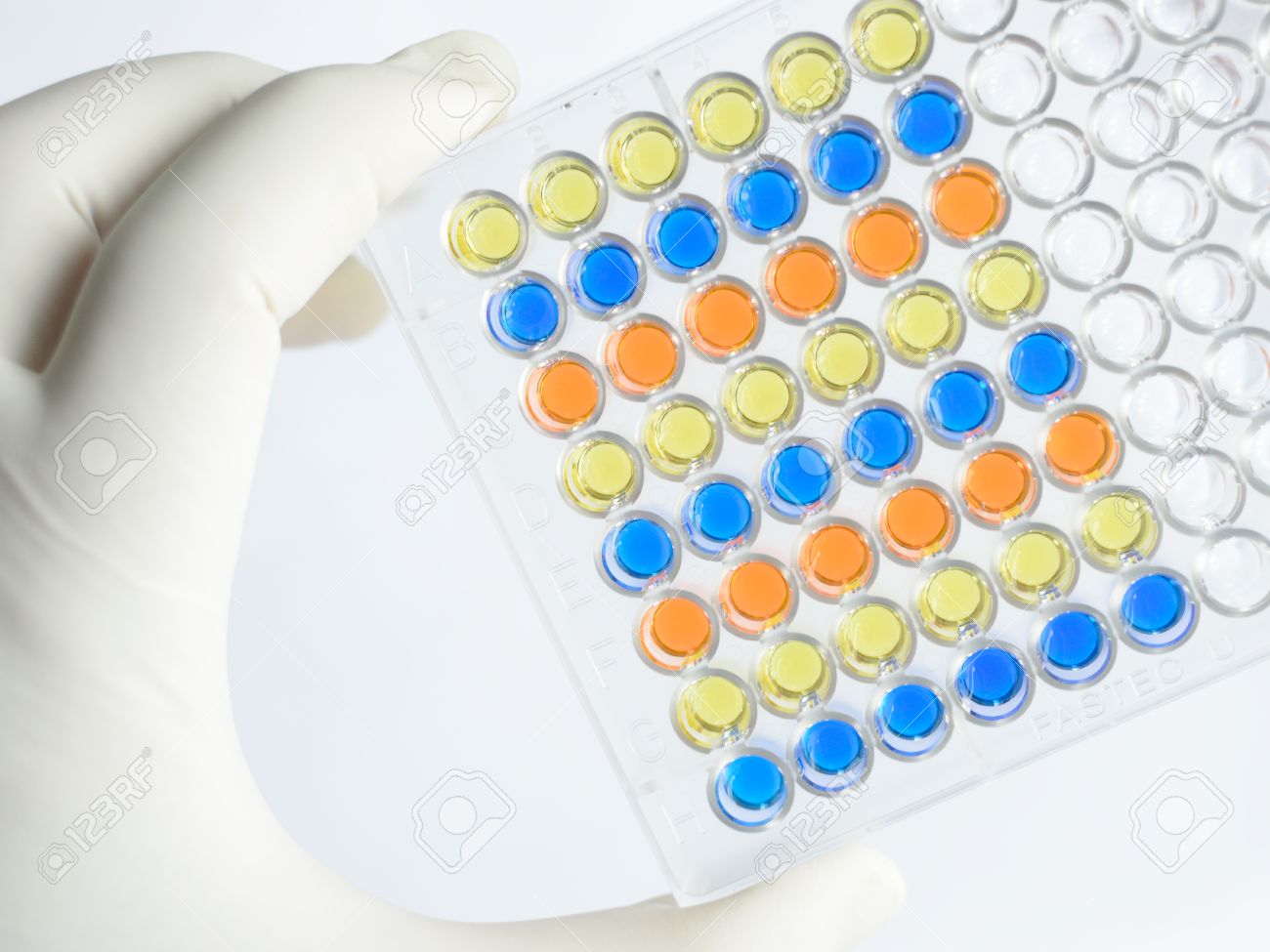 enzyme immunoassay