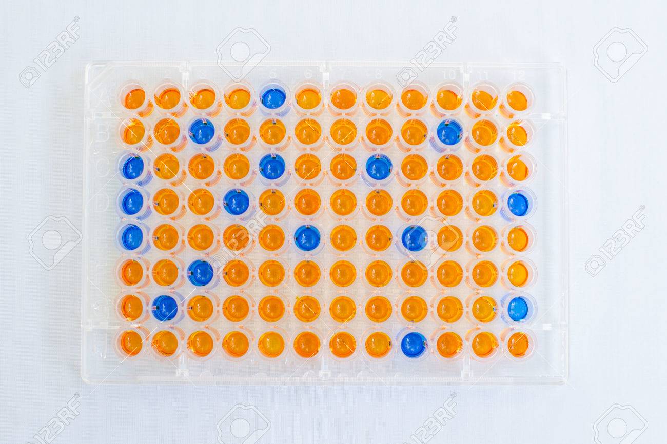 enzyme linked immunosorbent assay elisa immunology testing method enzyme linked immunosorbent assay