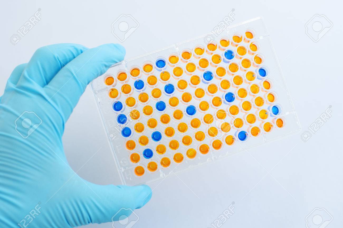 enzyme linked immunosorbent assay elisa immunology testing method enzyme linked immunosorbent assay