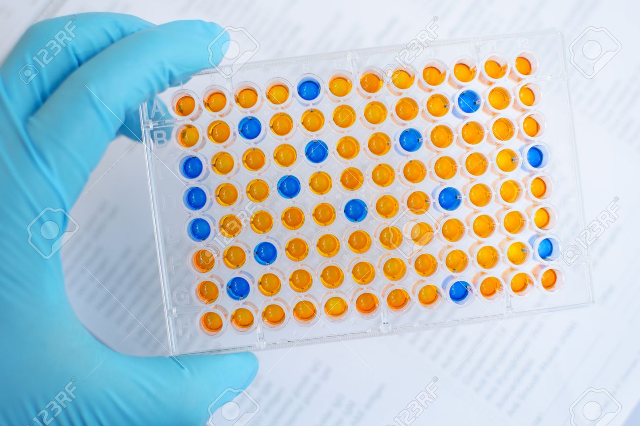 enzyme linked immunosorbent assay elisa immunology testing method enzyme linked immunosorbent assay