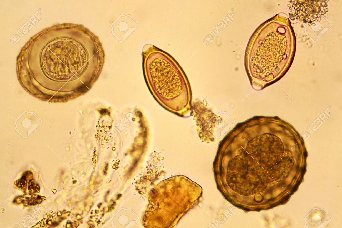 helminth eggs images helminth eggs images