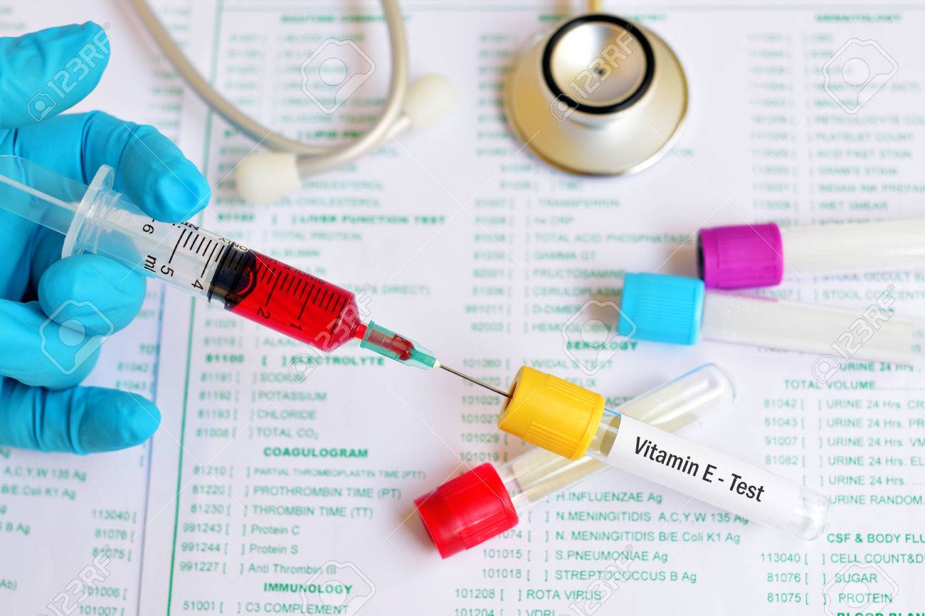 vitamine test vitamine test