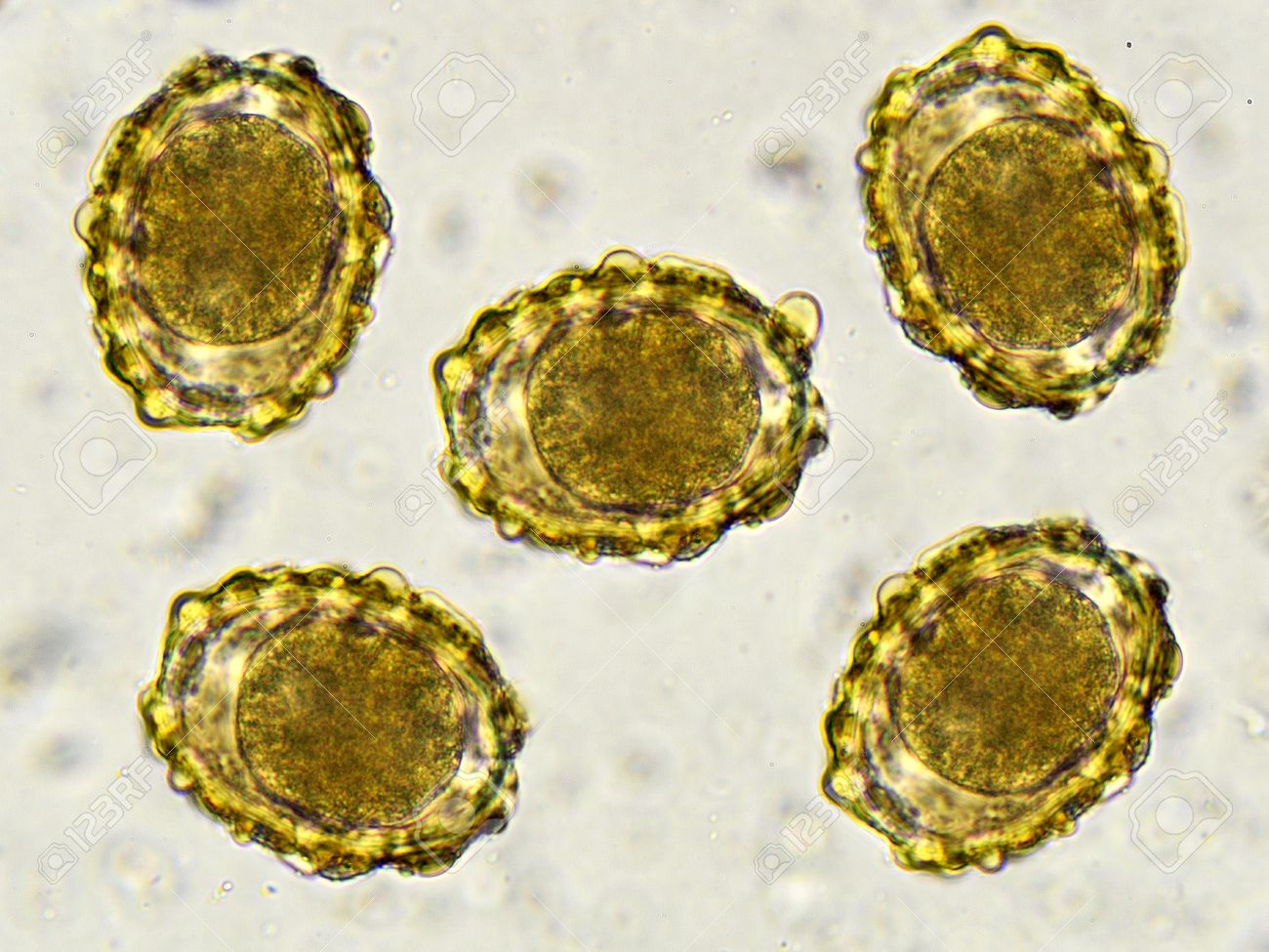 ascaris lumbricoides oeuf