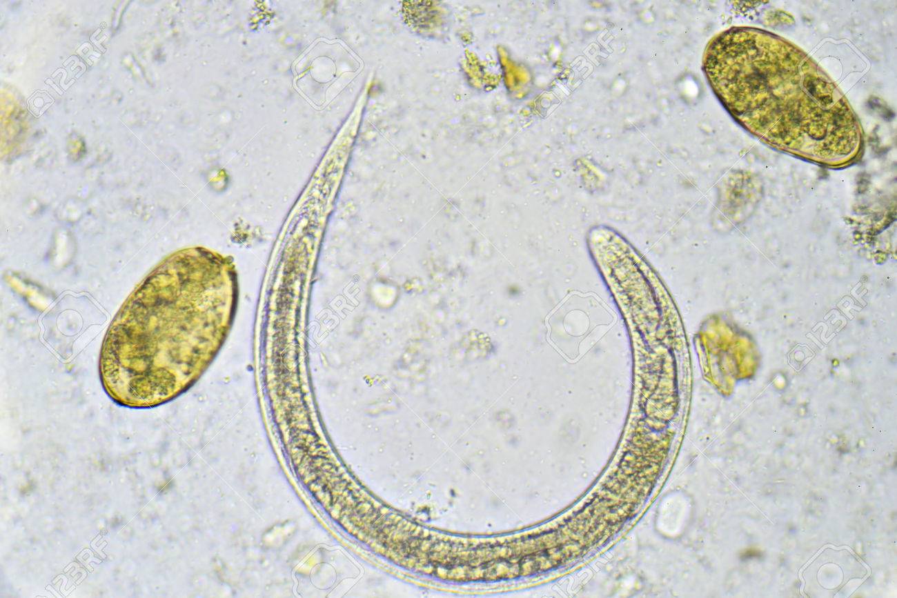 strongyloides stercoralis in stool