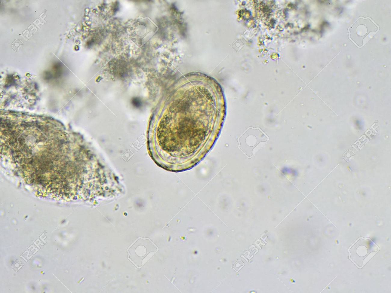 egg of ascaris lumbricoides in stool stock photo picture and
