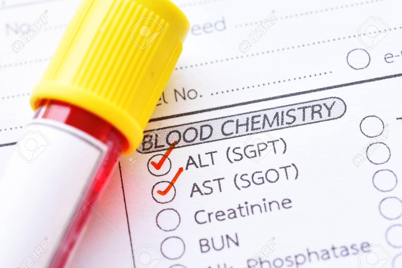 Liver function tests lft ast alt Liver function tests