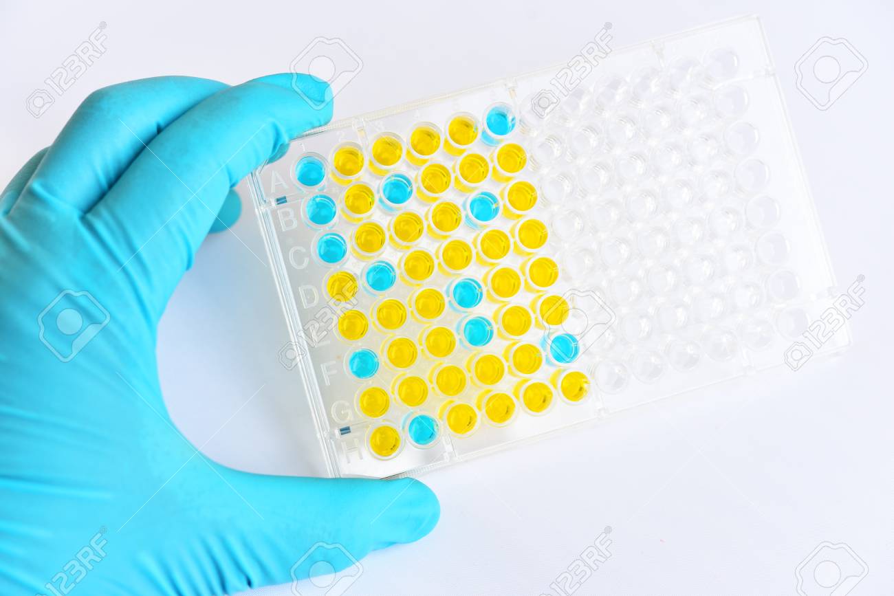 lab technician holding elisa plate in research laboratory elisa lab