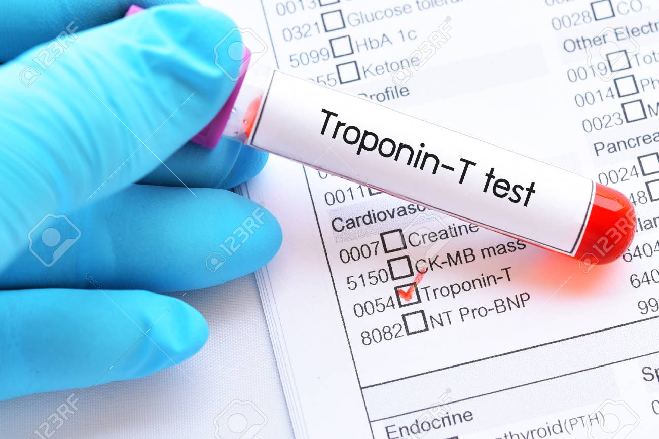 Blood Sample Tube For Troponin T Test Stock Photo Picture And Royalty Free Image Image 110253076