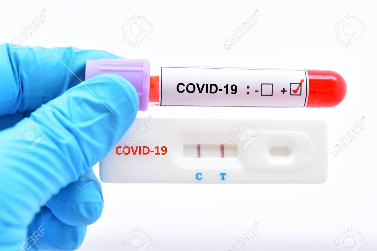 Positive test result by using rapid test device for COVID-19 virus - 143659651 Positive test result by using rapid test device for COVID-19 virus - 143659651