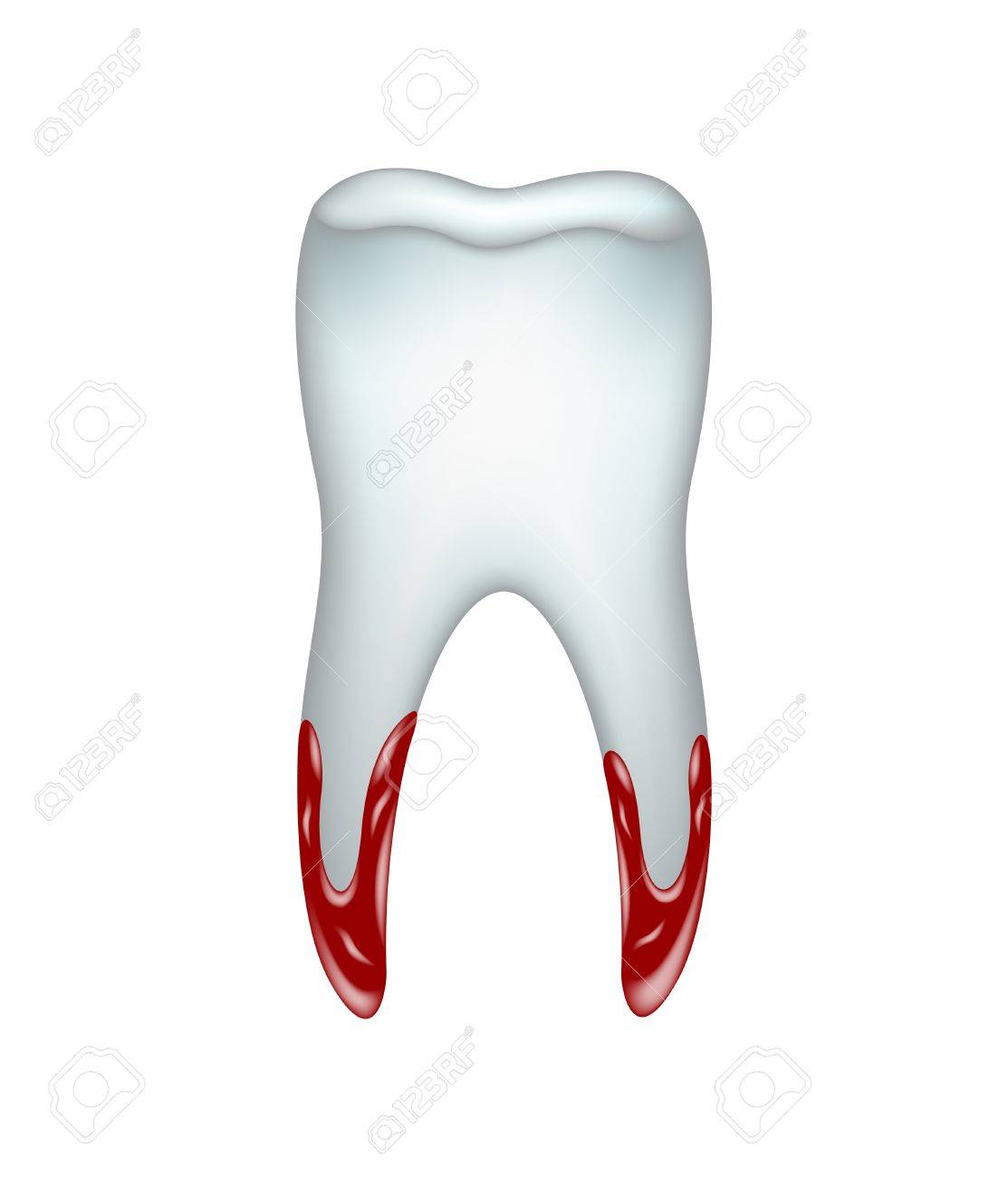Pulled Tooth With Blood Royalty Free SVG, Cliparts, Vectors, And Stock  Illustration. Image 17128149.