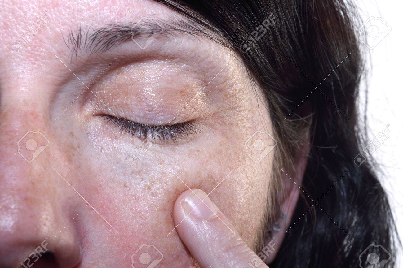 wrinkles under eyes at 40