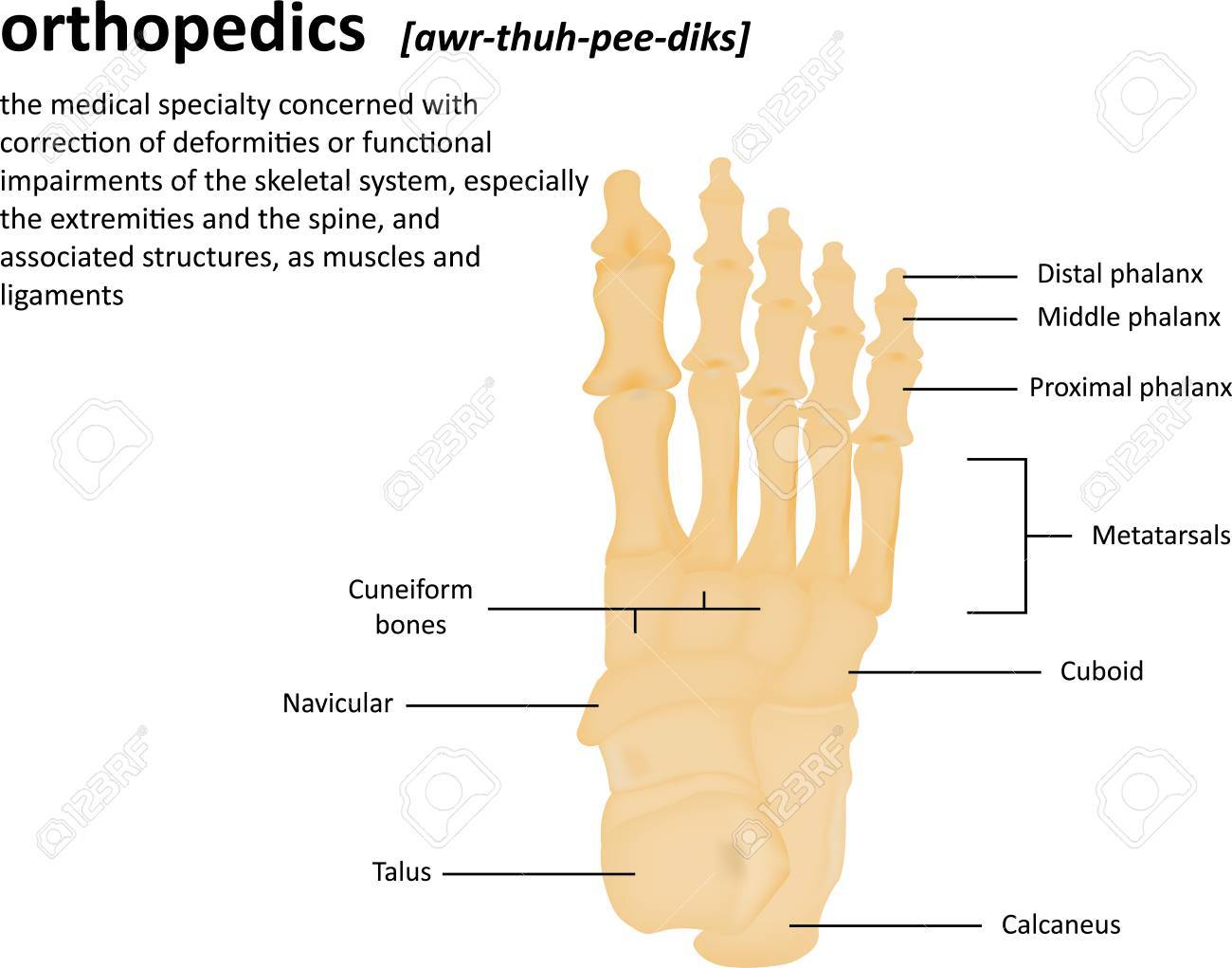 Orthopedics Definition Stock Photo Picture And Royalty Free Image Image 44343362