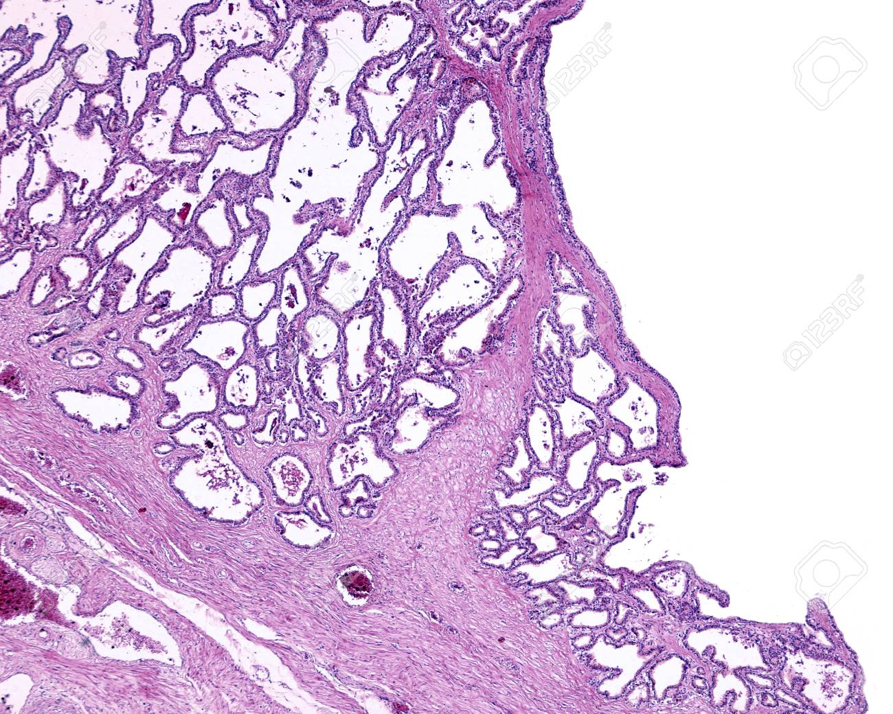 ghiandola seminale